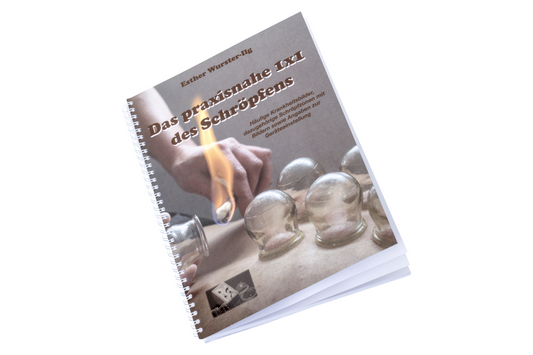 Das praxisnahe 1 x 1 des Schröpfens - Buch